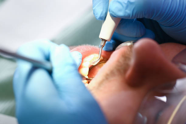Best Emergency Dental Care for Sports Injuries in Baden, PA