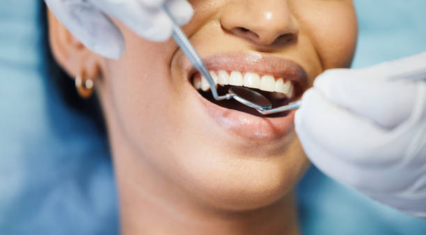 Best Emergency Wisdom Tooth Extraction in Baden, PA